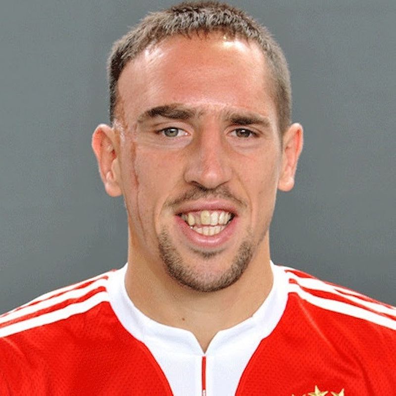 Frank Ribery - Gã mặt sẹo với kỹ thuật đỉnh cao